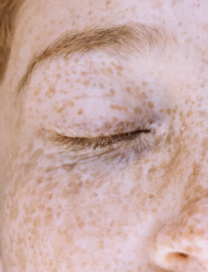 Dark Spot Face Cream med Kojic Acid Indhold: 50 ml - Image 2